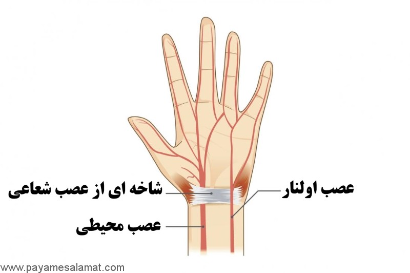 گرفتگی عصب اولنار ؛ علت، نشانه ها، تشخیص و روش های درمان