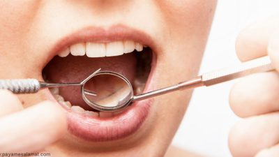 علت ایجاد تاول خونی در دهان و روی زبان چیست و چه زمانی باید به پزشک مراجعه کرد؟