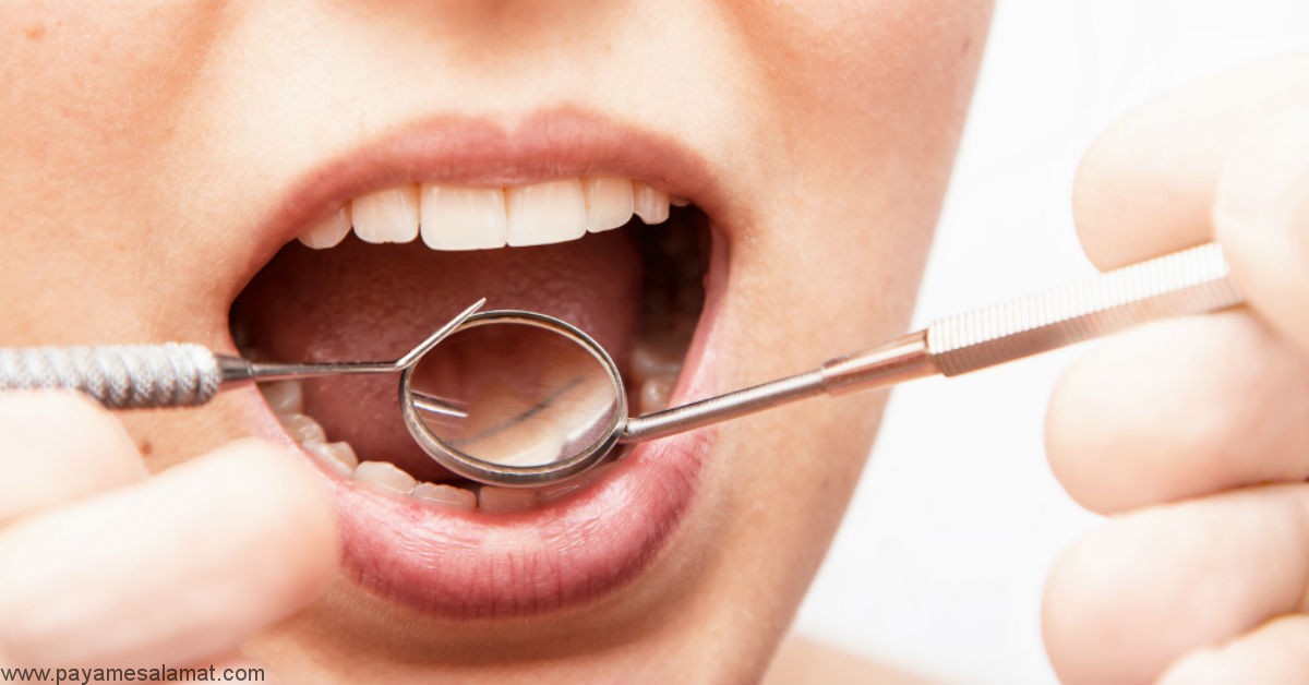 علت ایجاد تاول خونی در دهان و روی زبان چیست و چه زمانی باید به پزشک مراجعه کرد؟