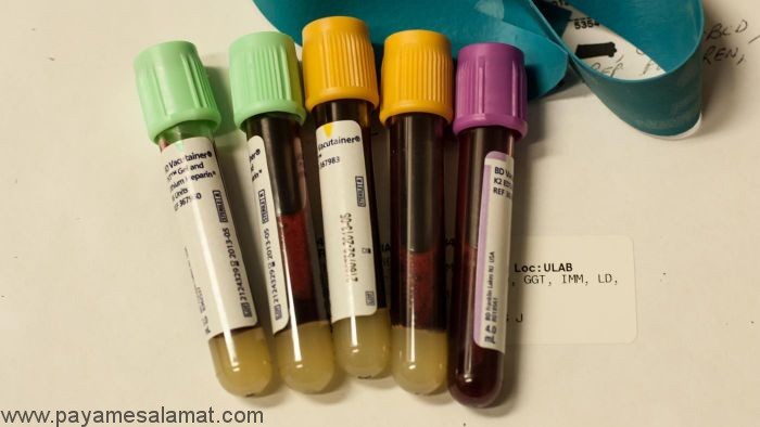 علل بالا بودن سطح آمونیاک خون چیست؟