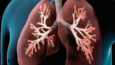 روش خانگی و ساده برای درمان بیماری مزمن انسدادی ریه (COPD)