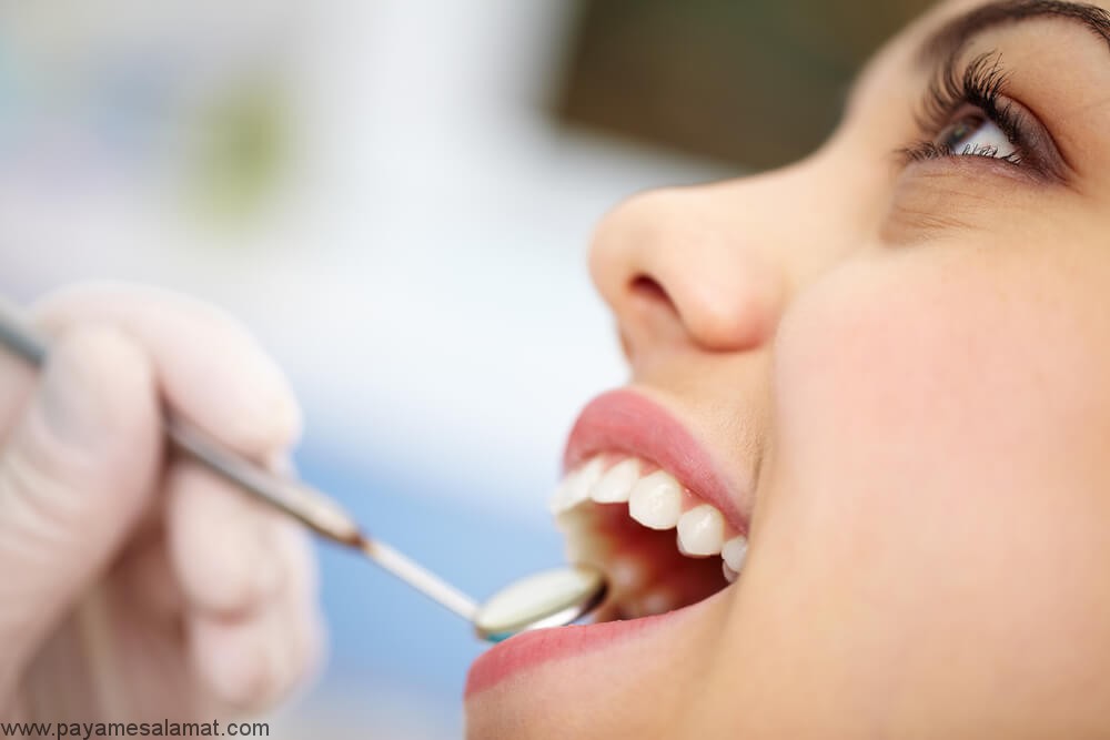 عوارض پل یا بریج دندان چیست؟