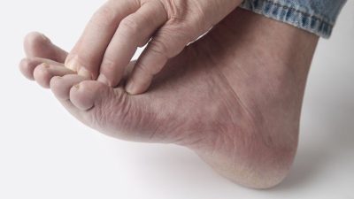 علل نوروپاتی در پاها و ساق پاها چیست؟