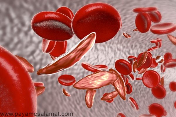علل، علائم، روش های تشخیص و درمان کم خونی مگالوبلاستیک