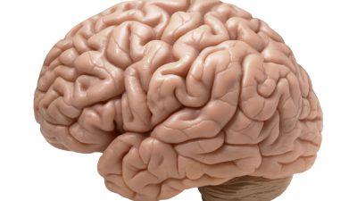 علائم آتروفی مغز (کوچک شدن مغز) چیست؟