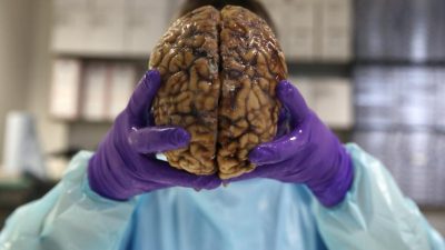 معرفی و آشنایی با بیماری های پوشش مغز