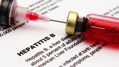 هپاتیت B ؛ نشانه ها، علل، عوامل خطر، عوارض، روش های پیشگیری، تشخیص و درمان