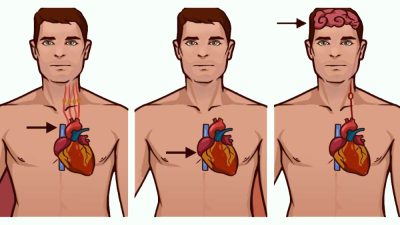 تفاوت حمله قلبی، ایست قلبی و سکته مغزی چیست و این بیماری ها چه نشانه هایی دارند؟