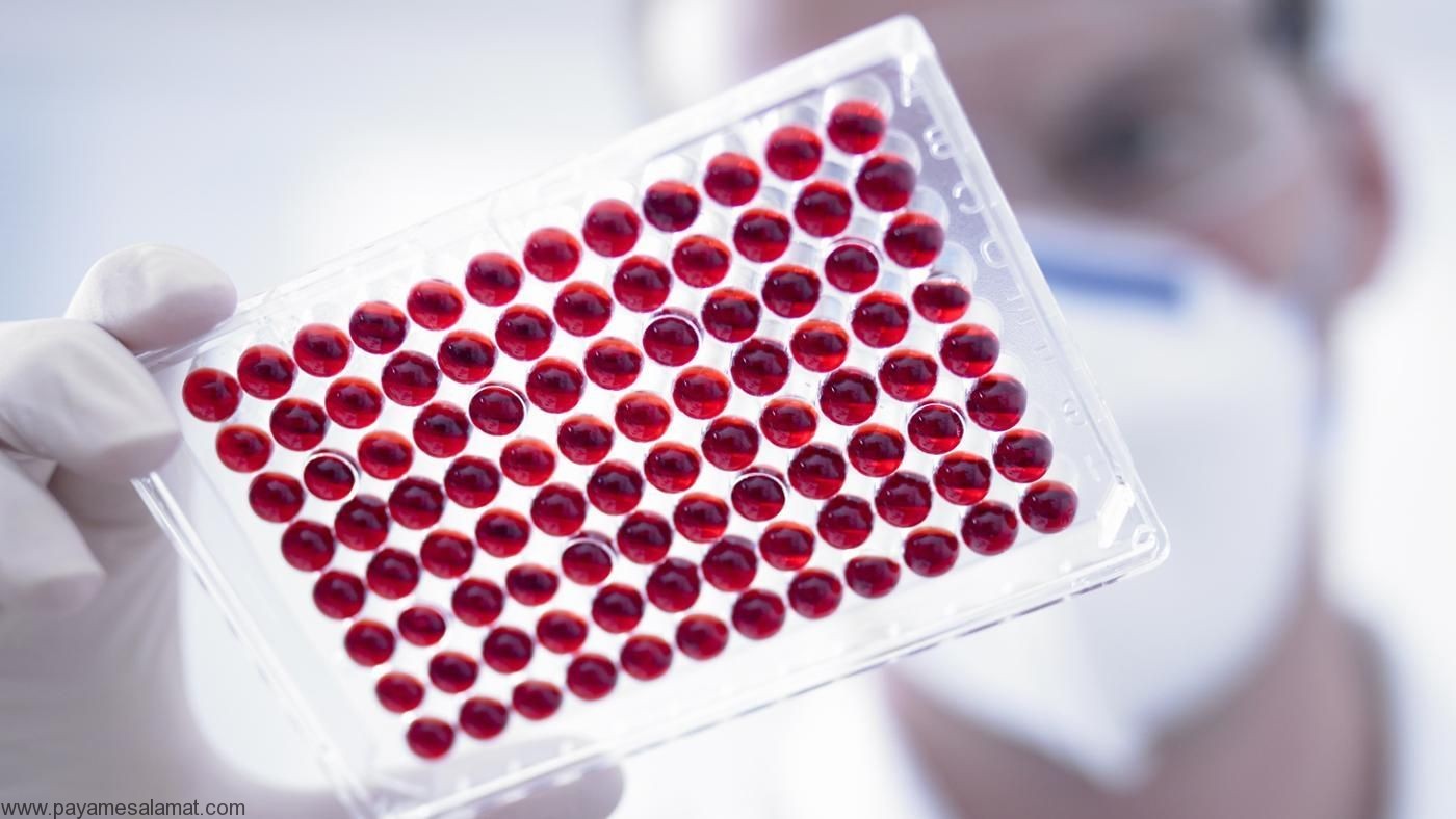 آزمایش خون MPV ؛ این آزمایش به چه معنی است و چه چیزی درباره سلامت شما می گوید؟