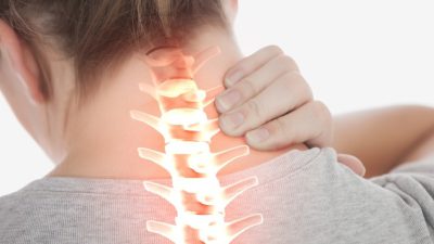 اسپوندیلوز گردن ؛ علل، عوامل خطر، نشانه ها، تشخیص و روش های درمان