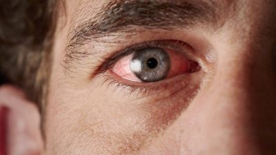بیماری چشم مرتبط با دیابت ؛ انواع، نشانه ها، روش های تشخیص و روش های درمان