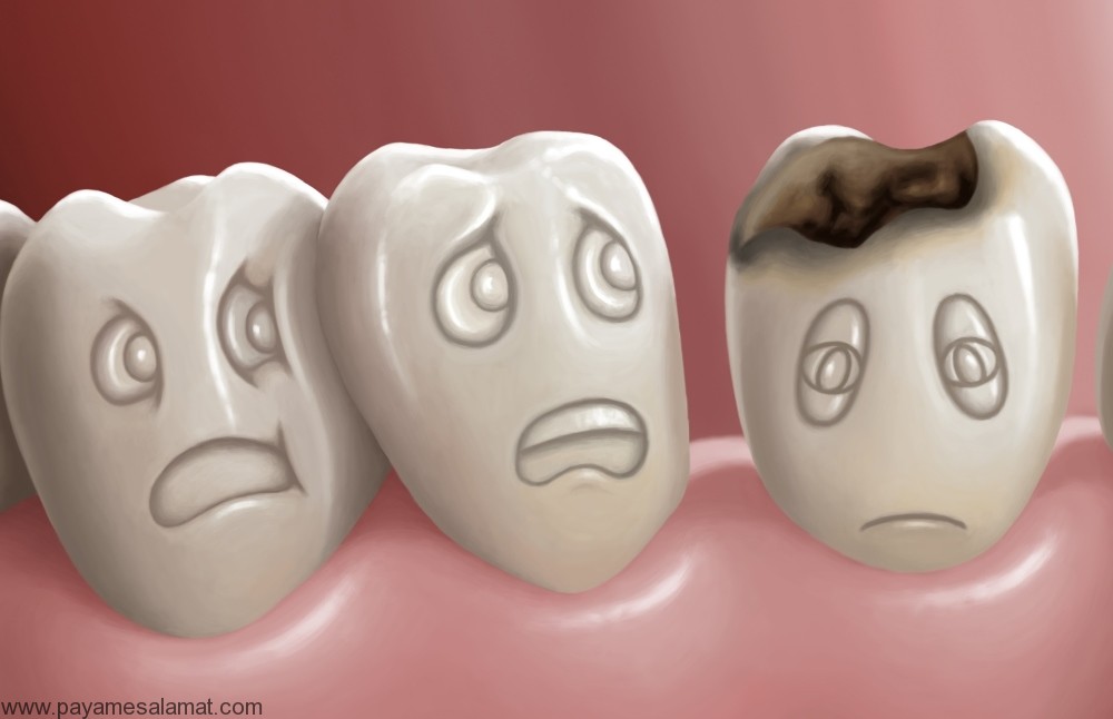 روش های خانگی برای درمان پوسیدگی دندان