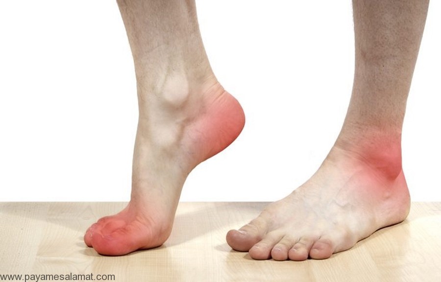 علل ایجاد پا درد دائمی و روش های مقابله با آن