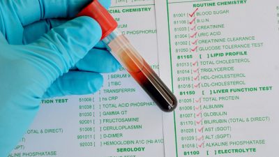 آزمایش خون CPK چیست و علت افزایش آن در نتایج آزمایش خون چه می باشد؟