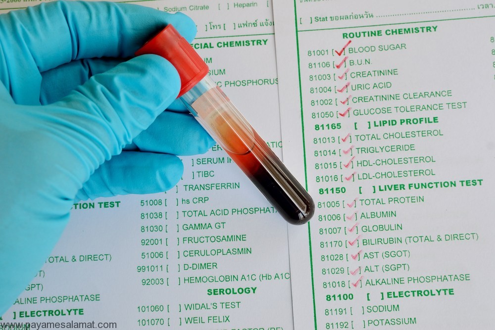 آزمایش خون CPK چیست و علت افزایش آن در نتایج آزمایش خون چه می باشد؟