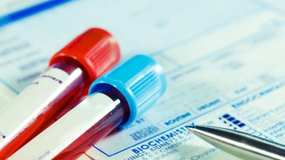 بالا بودن MCHC در آزمایش خون به چه معنی است و علائم، علل و روش های درمان آن کدامند؟