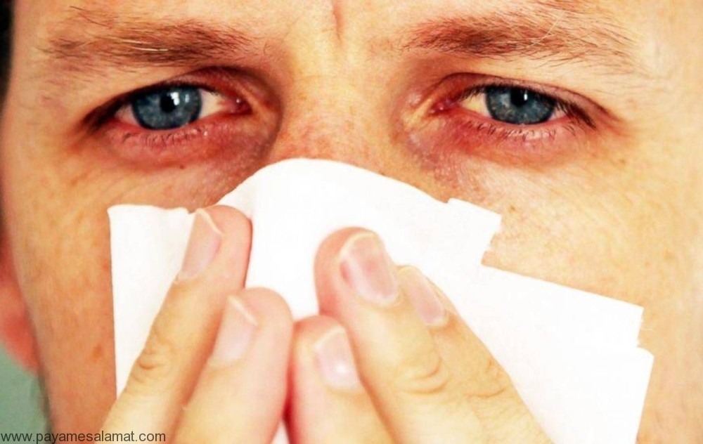 روش های طبیعی برای پیشگیری و درمان آلرژی به کپک