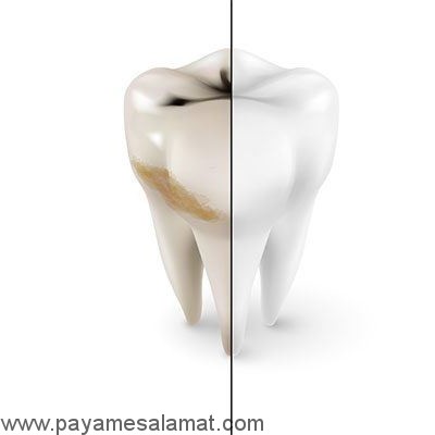 خواص مریم گلی (ساج) برای بدن