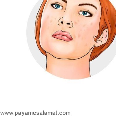 کاربردهای پوست موز