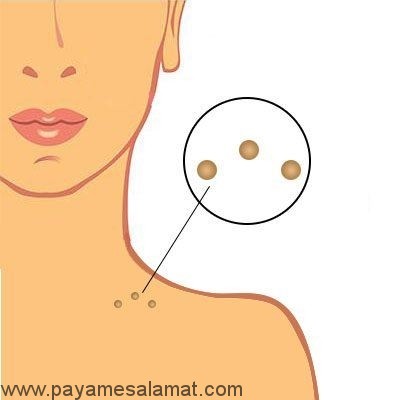 کاربردهای پوست موز