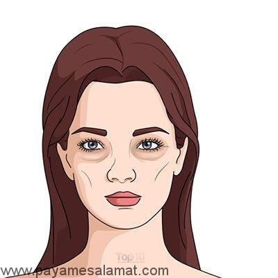 کاربردهای پوست موز