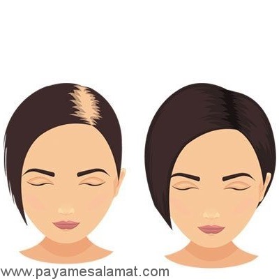 خواص مریم گلی (ساج) برای بدن