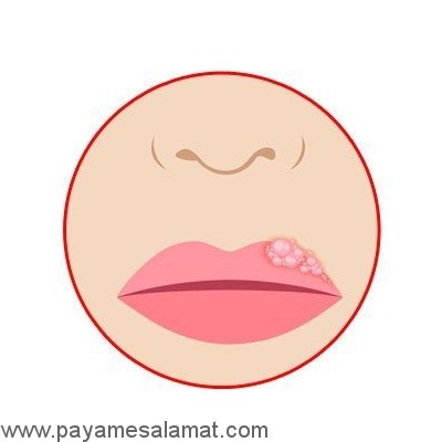 کاربردهای نمک در حل مشکلات مختلف در بدن و انجام کارهای خانه