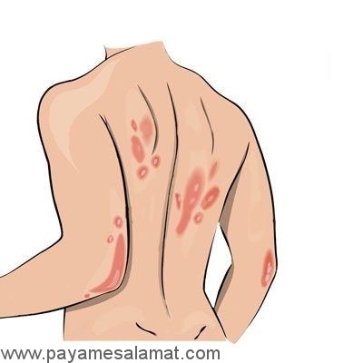 کاربردهای پوست موز