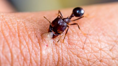 روش های خانگی درمان گاز گرفتگی مورچه به کمک مواد طبیعی و ساده