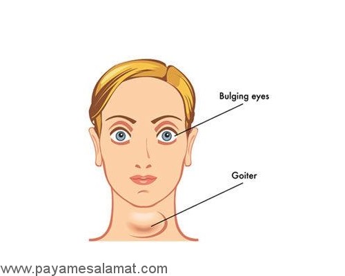 بیماری هایی که باعث کاهش وزن می شوند