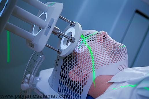 عوارض جانبی پرتو درمانی تومور مغزی و ارائه نکاتی برای مقابله با برخی از این عوارض جانبی