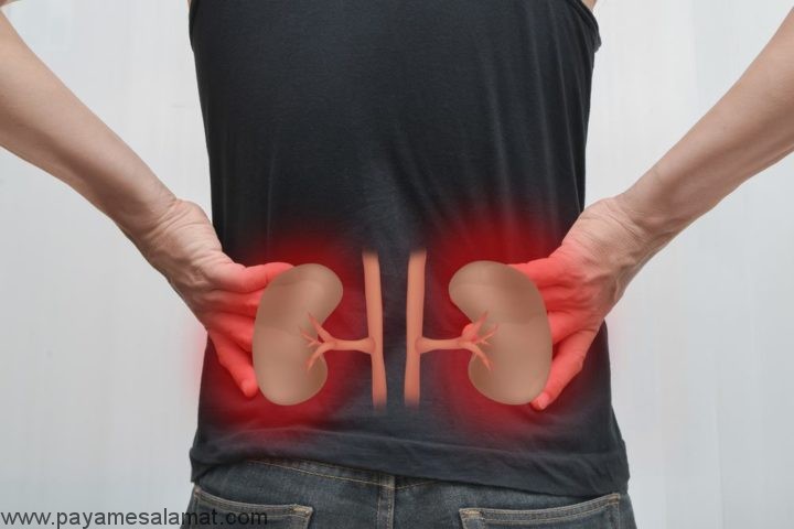 نشانه های سنگ کلیه و علائم اولیه ای که نباید نادیده گرفته شوند