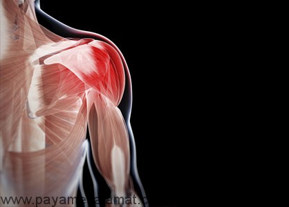 میوزیت ؛ نشانه ها، علل، درمان و ۶ راه طبیعی برای کنترل آن