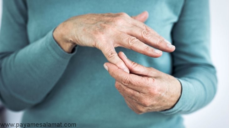 علائم اولیه بیماری استئوآرتریت
