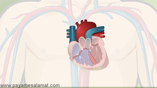 سندرم آیزن منگر