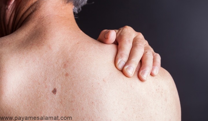 تاندونیت شانه چیست و چه نشانه هایی دارد؟