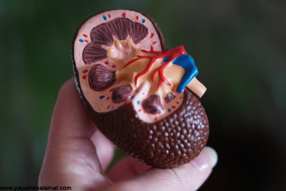 picture of kidney stones in humans picture of kidney stones in humans